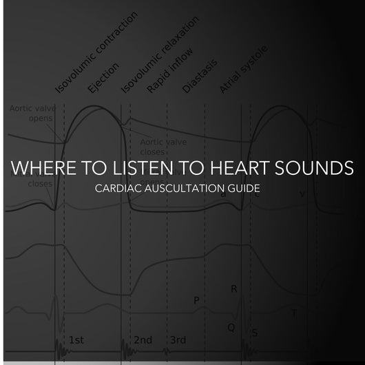 Where to Listen to Heart Sounds: A Guide to Cardiac Auscultation Landmarks