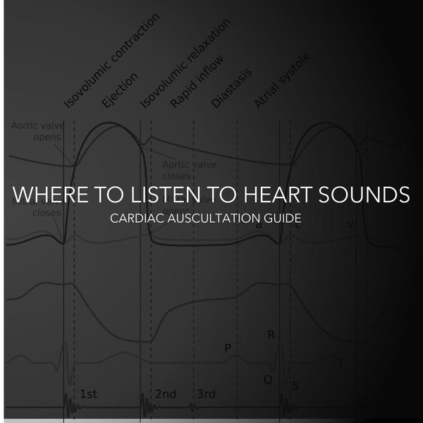 Where to Listen to Heart Sounds: A Guide to Cardiac Auscultation Landmarks