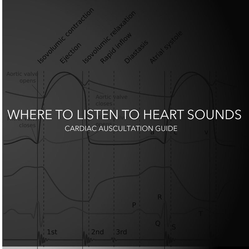 Where to Listen to Heart Sounds: A Guide to Cardiac Auscultation Landmarks